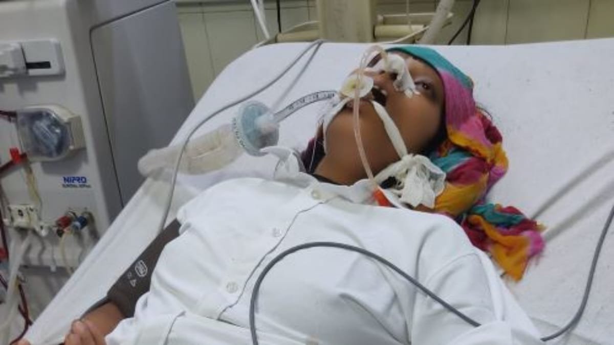 बीकानेर: पीबीएम में भर्ती गंभीर प्रसूता प्रीति की मौत, मल्टीपल ऑर्गन फेल्योर बना कारण
