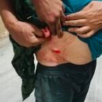 बीकानेर में दिनदहाड़े चाकूबाजी: पुरानी रंजिश में युवक पर हमला, ट्रैफिक जवान की बहादुरी से एक आरोपी दबोचा
