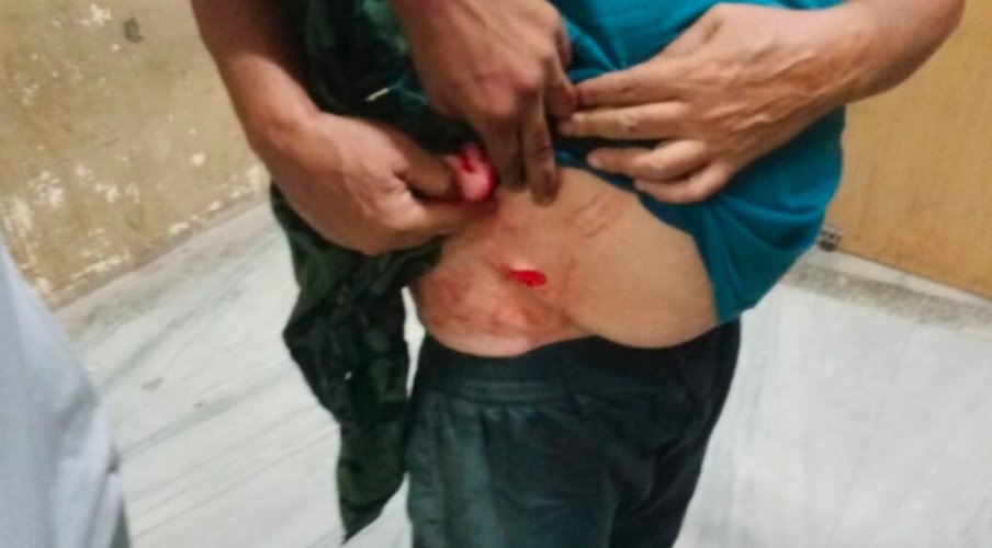 बीकानेर में दिनदहाड़े चाकूबाजी: पुरानी रंजिश में युवक पर हमला, ट्रैफिक जवान की बहादुरी से एक आरोपी दबोचा